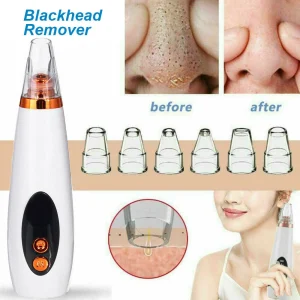 Electric Blackhead Removal Tool, Electric Blackhead Remover Facial Skin Pore Cleaner Vacuum Acne Cleanser